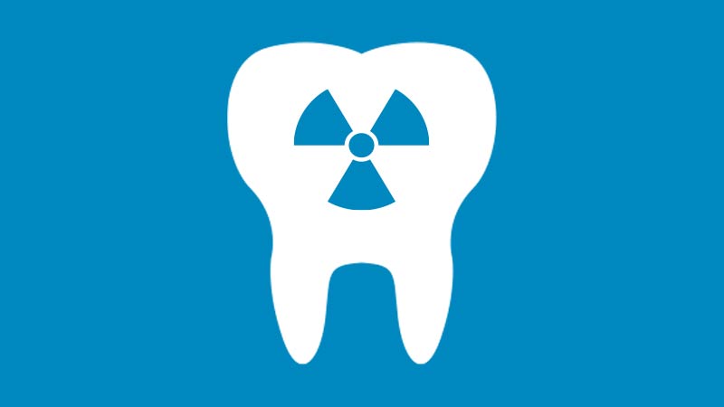 Radiografie in sede